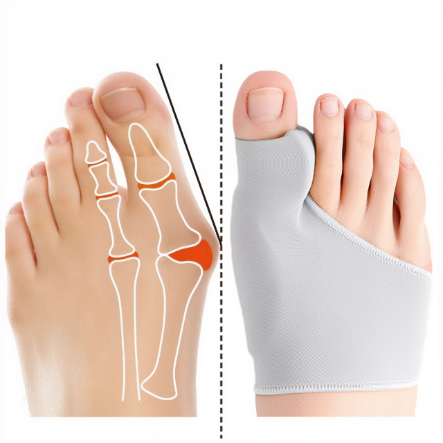 Correcteur en gel transparent pour hallux valgus, vue de face