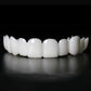 Gros plan sur des dents recouvertes de facettes