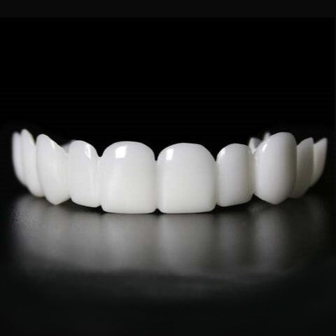 Gros plan sur des dents recouvertes de facettes