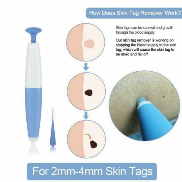 Démonstration de l'utilisation du kit sur la peau