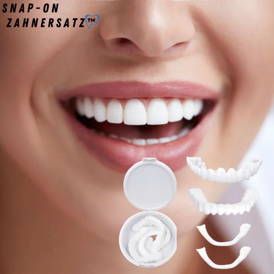 Facettes dentaires blanches posées sur un modèle de dents