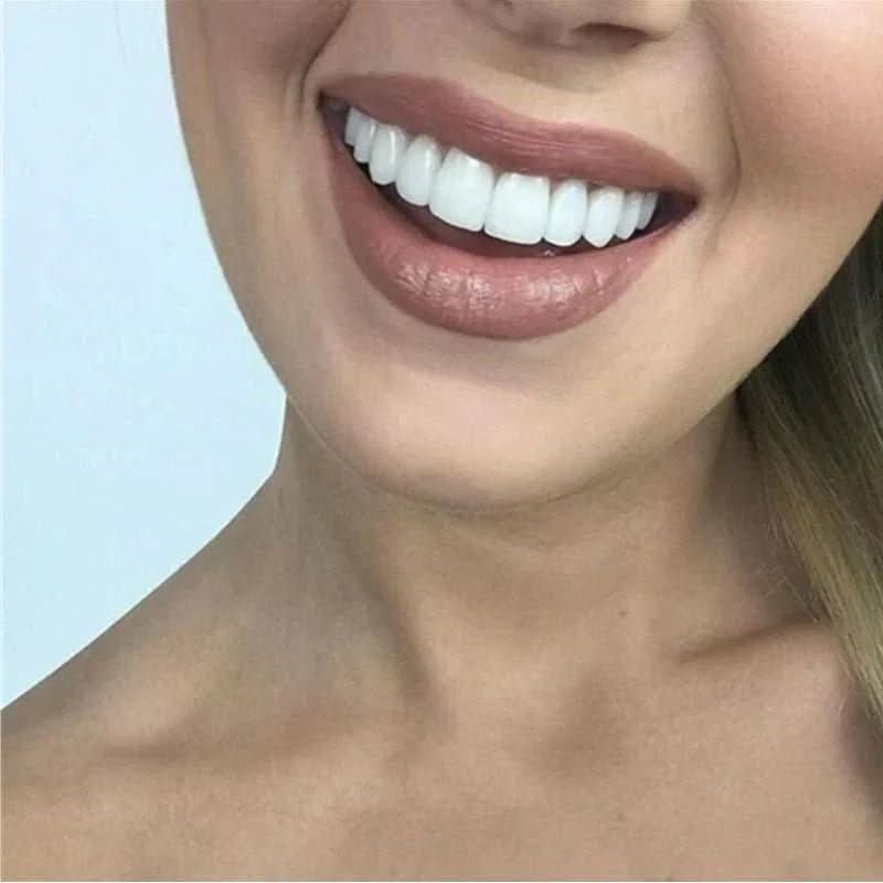 Gros plan sur facettes dentaires ajustables sans colle